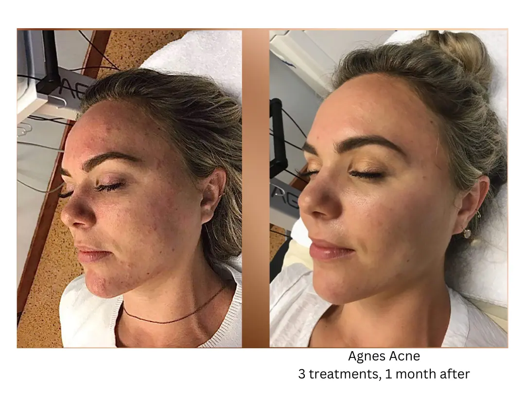 a collage of a woman with her eyes closed-lake-washington-medical-aesthetics-kirkland-WA