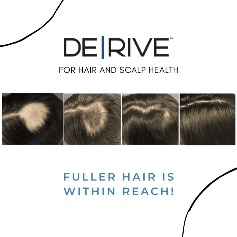 a collage of hair loss-lake-washington-medical-aesthetics-kirkland-WA